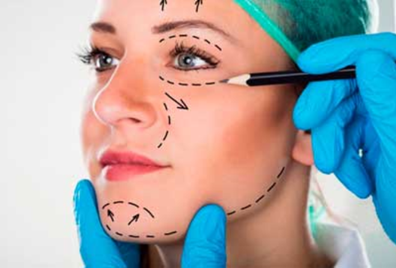 Candidatos para cirugía facial